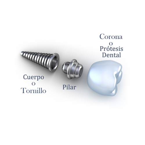 COMPONENTES IMPLANTES